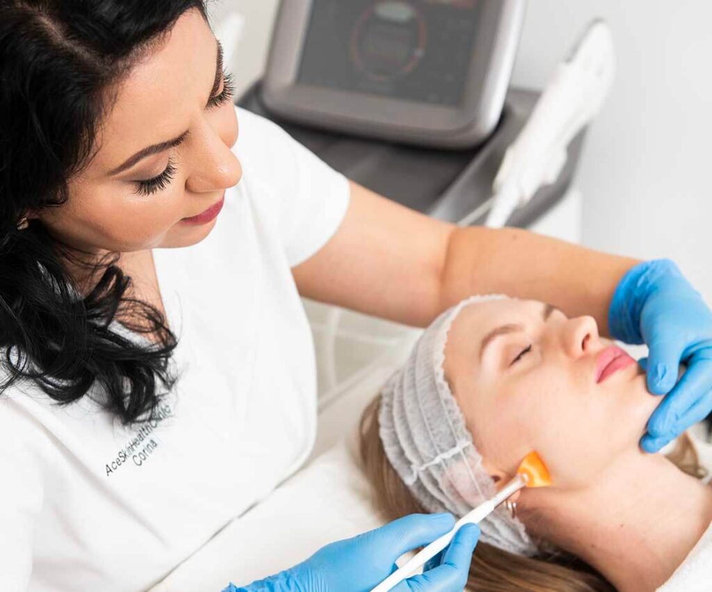 ace skin health clinic chemical peels